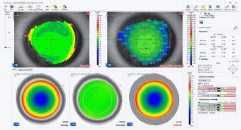 Schwind peramis screenshot topo aberro comparison maps internal wf