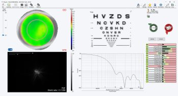 Schwind peramis screenshot visual quality