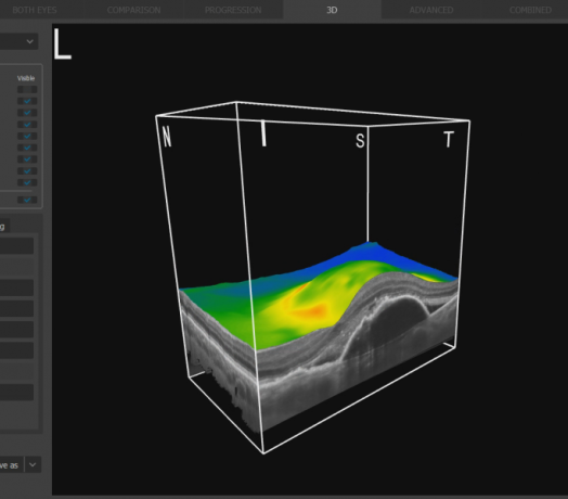 REVOFC OD 3 D e1648155431864