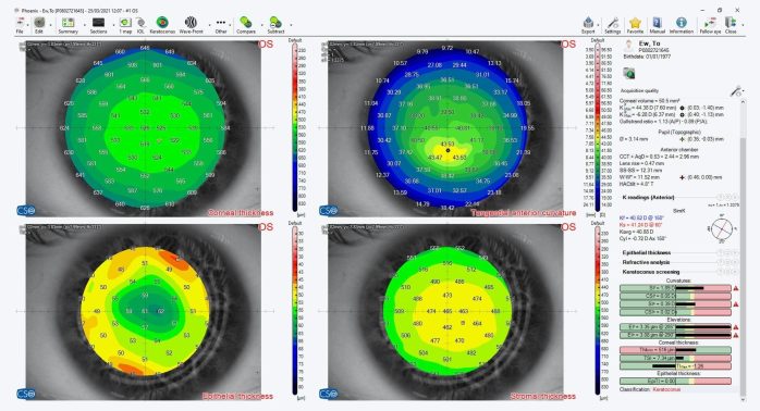 Schwind ms 39 screenshot overview 4maps epithelial