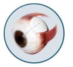 Eye Plate S platedesigd