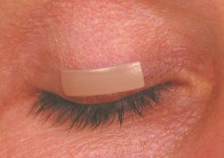 FCI S3 600 X External Eyelid Weights