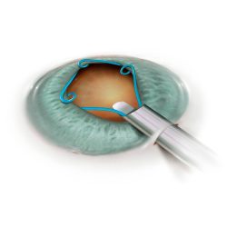 Malyugin Ring800x800