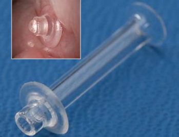 Stop Loss Jones Tubes reflux