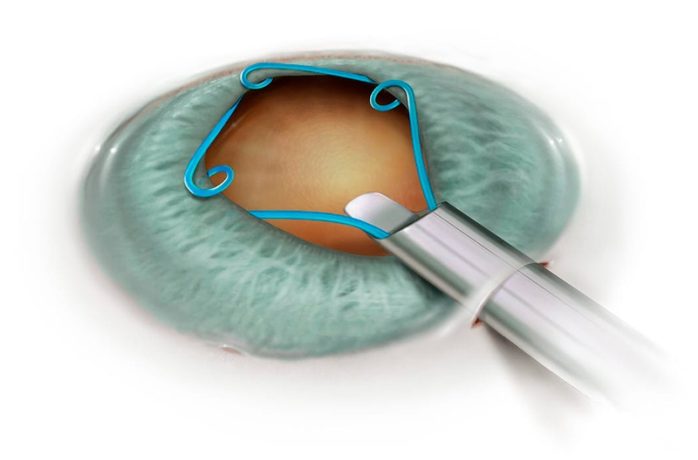 Malyugin Ring800x800